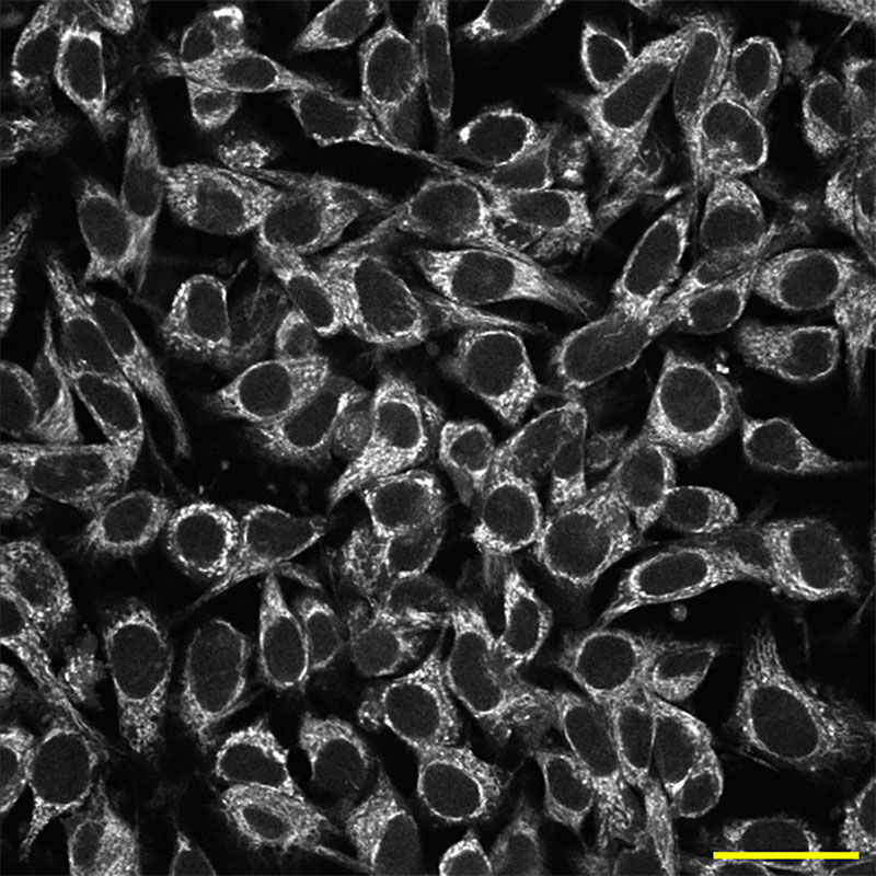 NAD(P)H intensity image of mouse melanoma